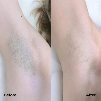 Elektrischer Damenrasierer | Sanfte Haarentfernung | Doppelkopf | Wasserdicht | Kabellos