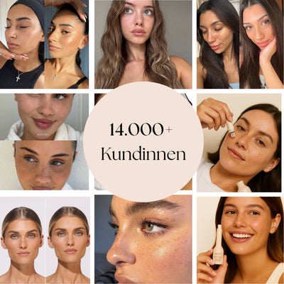 SonnenPunkte™ Verspielter Beauty-Akzent