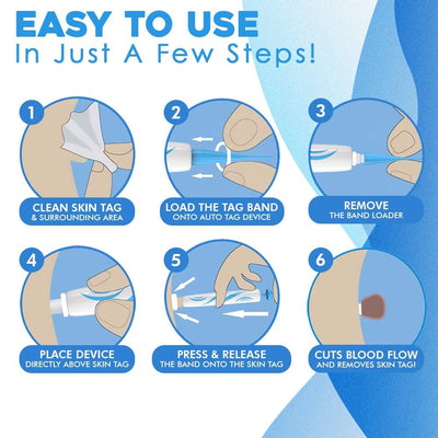 WarzenWeg™ Schmerzfreie Warzenentfernung