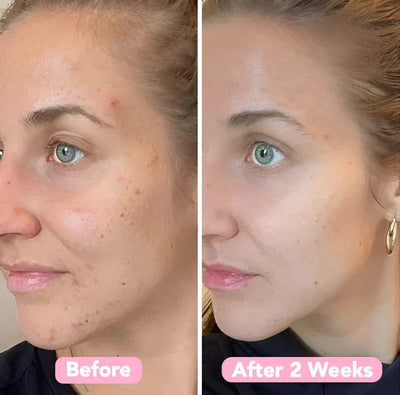 FrischAura™ Strahlende Glow-Reinigung